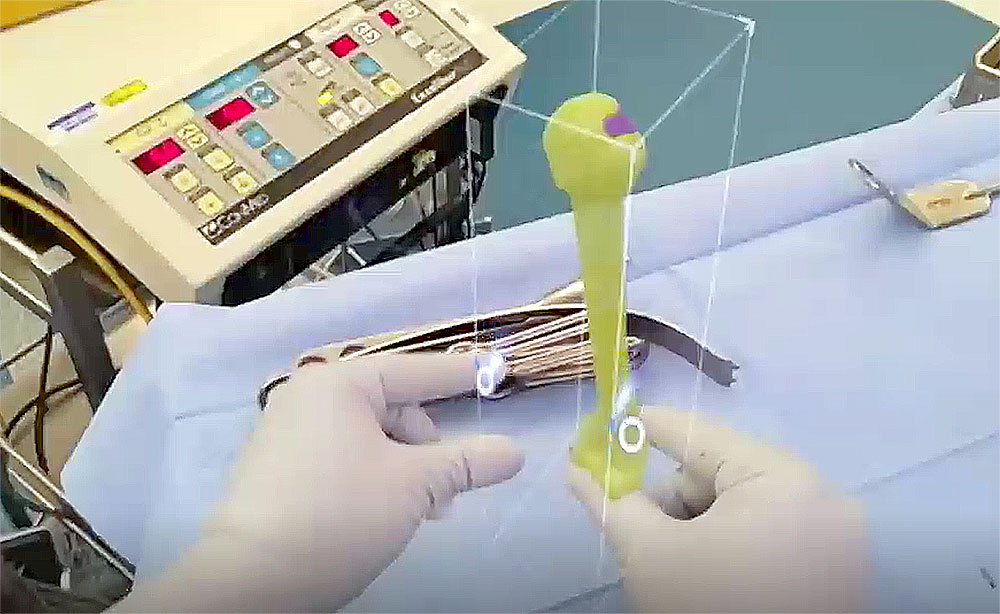 3D holographic technology used in shoulder surgery 